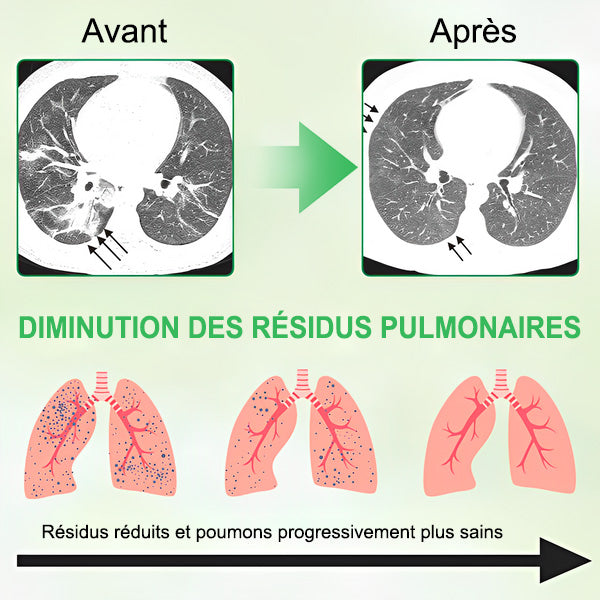 💥💖 GFOUK® Spray de Nettoyage Pulmonaire au Bouillon-blanc Concentré 3X — Pour la difficulté à expectorer, l'essoufflement, l'excès de mucus, la bronchite et les infections pulmonaires