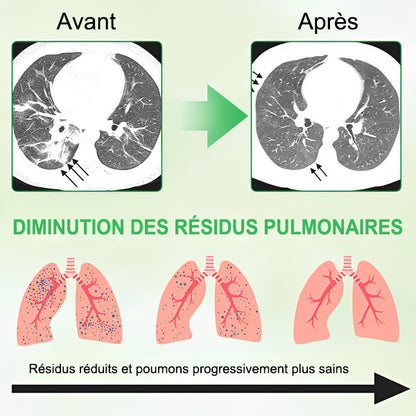 💥💖 GFOUK® Spray de Nettoyage Pulmonaire au Bouillon-blanc Concentré 3X — Pour la difficulté à expectorer, l'essoufflement, l'excès de mucus, la bronchite et les infections pulmonaires